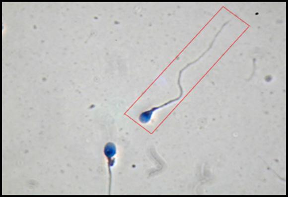la cabeza y cola) Espermatozoide