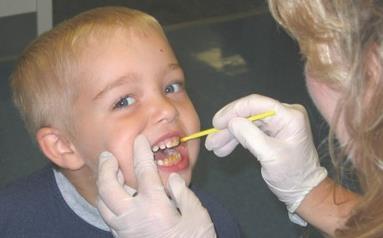 FLUORTERAPIA EN NIÑOS La fluorterapia es el tratamiento no invasivo de mayor eficacia en el control de la caries dental, avalado categóricamente por