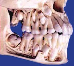 Todos los dientes temporarios y el molar permanente comienzan a calcificar en el claustro materno. Hacia el sexto mes de vida intrauterina todos estos dientes ya empezaron su calcificación.