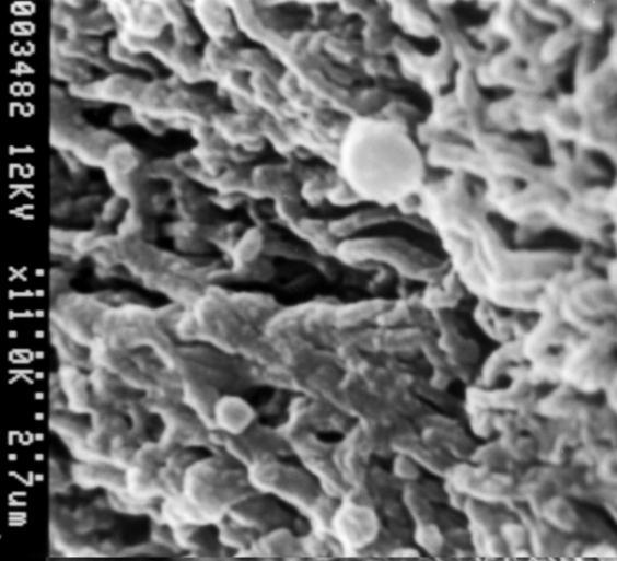 FHA Figura 2. Microfotografía electrónica de FRP (2,7 µm). Se señala fibrina homogénea abierta y sobre ella plaquetas en forma de bola de diferentes tamaños.