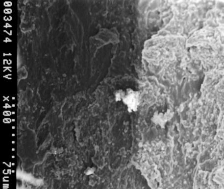 a) b) Figura 3. A) Microfotografía electrónica de PRP con Hidroxiapatita (75 µm). Se observa un grupo de hidroxiapatita (círculo) incluida en una superficie de fibrina homogénea.