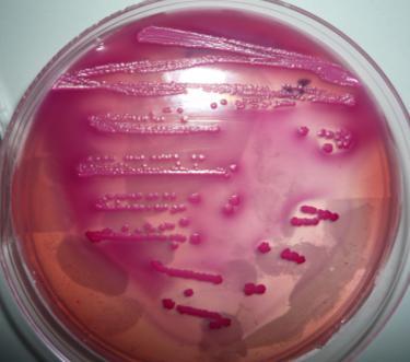 Por la presencia de la lactosa, aquellas bacterias capaces de fermentarla acidifican el medio, cambiando el color del indicador rojo neutro presente en su composición, y formando colonias rojas