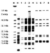 Fig 4. RFLP de diferentes aislados del complejo M. tuberculosis. Carril M, cepa control de MTB 14323; Carril H, cepa control de MTB; carriles del 1 al 8, aislados clínicos de MTB.