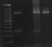 de aprox. 296pb, fragmento que corresponde a la mutación del codón 315 del gen katg y 13 aislados presentaron un fragmento de 146 pb que corresponde a la mutación en el gen inha (Fig.20).
