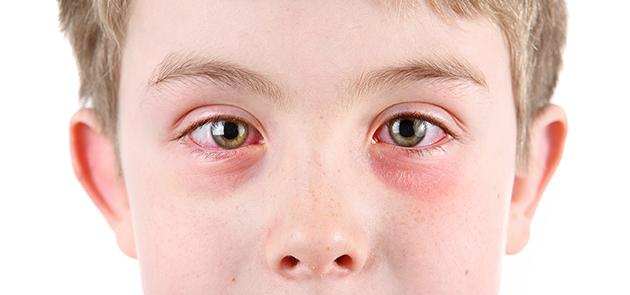 Rinoscopia Auscultación (asma) Ojos