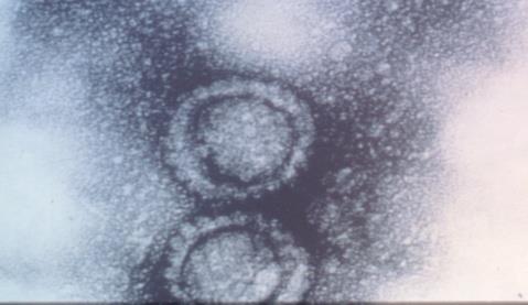 Iridovirosis de la dorada japonesa Necrosis hematopoyética