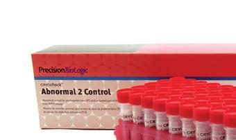 CRYOCHECK ABNORMAL CONTROL CCA-0 80 x,0 ml Plasma de control patológico nivel.