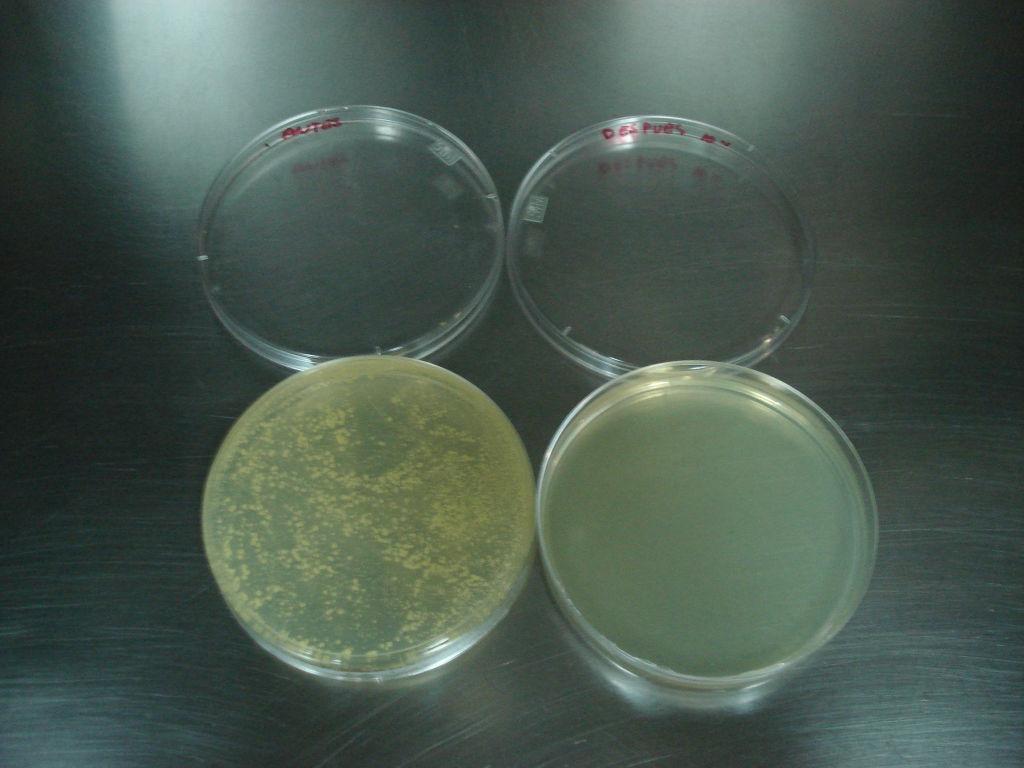 112 antes después Figura 6.5 Bacterias Tipo Mesofílicas Antes y Después de Utilizar el Equipo.