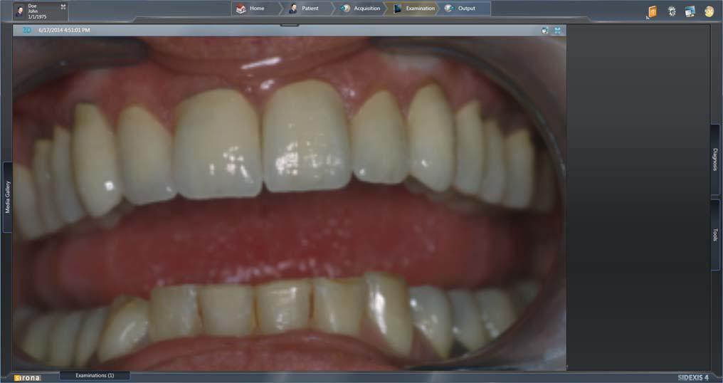 Sirona Dental Systems GmbH Plugin de Vídeo para SIDEXIS 4 TENEO / SINIUS / INTEGO 3 Manejo 3.4 Guardar imágenes 3.