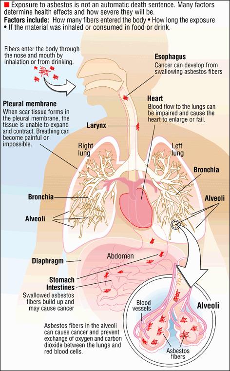 Se sabe que respirar asbesto puede aumentar el riesgo de cáncer en seres humanos.