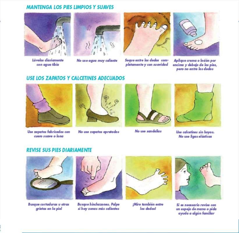 Intervención con fines preventivos En el pie sin lesión, además de las recomendaciones generales del cuidado de los pies, se debe recomendar un tipo de calzado