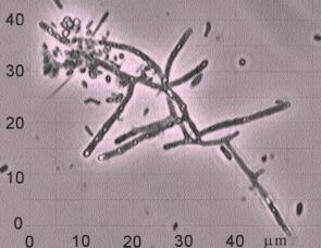 Haliscomenobacter hydrossis (Figura 12): Longitud: de 20 a 100 µm. Diámetro: de 0.3 a 0.5 µm. Filamentos rectos o torcidos. No se observan septos celulares ni constricciones.