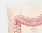 La conexión entre los dos extremos del intestino después de la extirpación de una sección se denomina anastomosis.