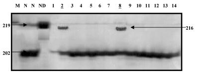 En el carril 4 se observa una banda de 492 pb, correspondiente al alelo 1 (variante M470), esta variante alélica no presenta sitio de restricción para la enzima Hph I; por lo tanto, el fragmento es
