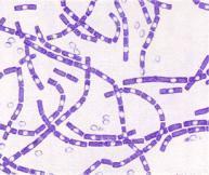 Género Clostridium Características