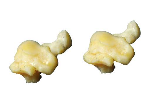 CARPO OSSA CARPI Medial Medialis : Pisiforme (Pisiforme) : Escafolunar (Scapho-lunare) : Trapezoide
