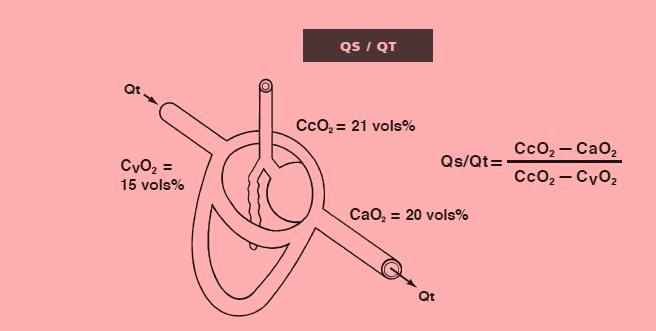 Shunt Qs/Qt = CcO2 CaO2 CcO2 CvO2 CcO2 = Contenido capilar de oxígeno (1,38 x Hb x 1) + (PAO2 x 0,0031) CaO2 = Contenido