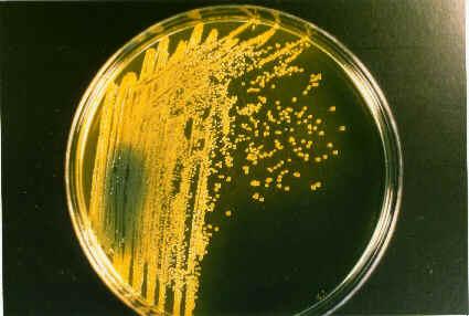 de S. En el agar TCBS las colonias crecen lisas, de color amarillo y muy pegajosas.