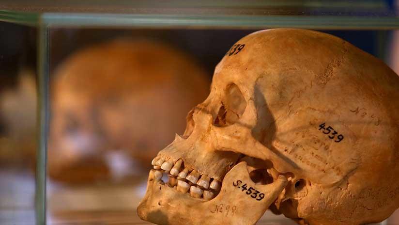 Experimentos raciales y colecciones privadas Los huesos humanos de los africanos tenían una gran demanda en Europa a principios del siglo XX.