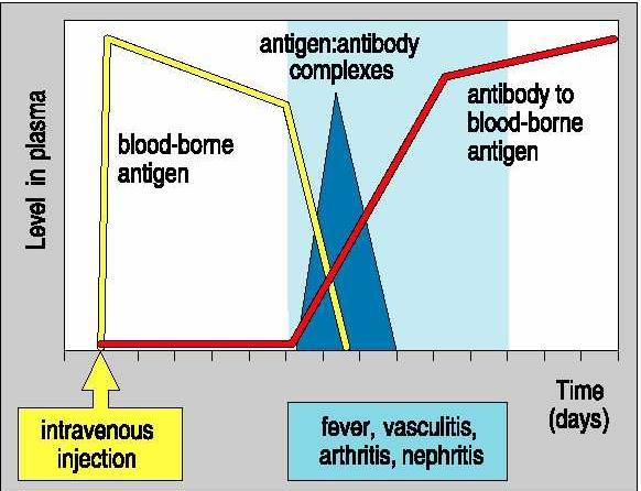 Enfermedad del suero - Es una enfermedad causada por inyección de grandes dosis de un antígeno proteico en sangre que se