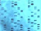 MEDICAL BIOTECHNOLOGY FORENSICS DNA fingerprinting allows for the identification of