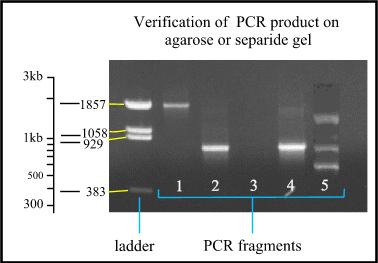 Detección y Análisis de los resultados Línea 1: fragmento de PCR de aproximadamente 1850 pares de bases de longitud.