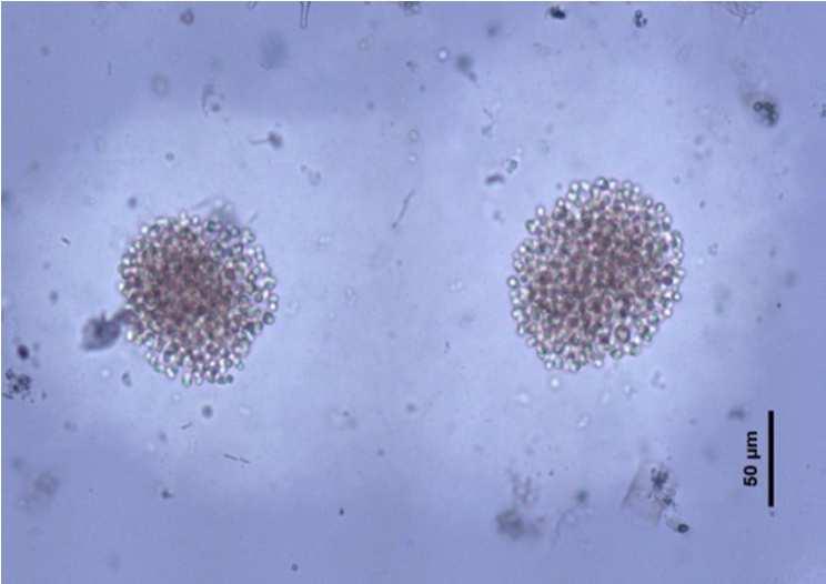 Vichuquen Microcistina LA (µg/l) -
