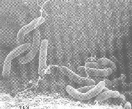 Agente etiológico Vibrio cholerae O1
