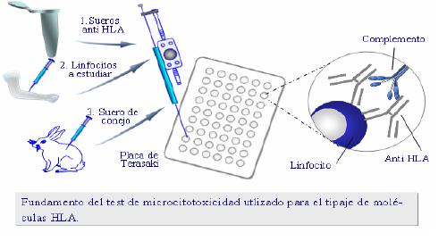 B.1. METODO SEROLOGICO El método serológico más comúnmente utilizado es el test de microlinfocitotoxicidad, que se realiza enfrentando una población de linfocitos a una batería de sueros o