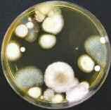 Materiales y métodos generales Figuras 11 y 12. Aspecto de las placas de Petri con medio agar-malta acidificado en el momento del conteo de las colonias, tras 5-6 días de incubación.