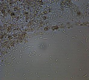 Fusarium oxysporum Micelio aéreo y blanco, que