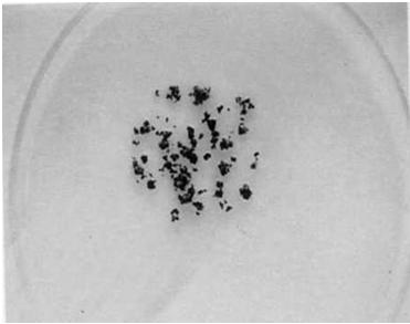 Examen Macroscópico de los gránulos Examen Microscópico en fresco Granos eumicóticos de Madurella mycetomatis Filamentos tabicados demateáceos de
