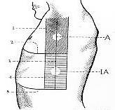 Líneas y regiones de la cara lateral del tórax Líneas: 1. Axilar anterior 2. Sexta costal 3. Axilar media 4. Axilar posterior 5. Reborde costal Regiones: A: Axilar. IA: Infraaxilar.