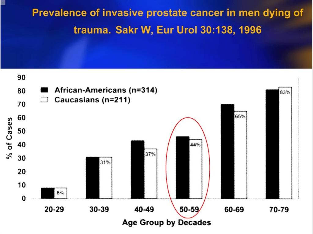 Introducción: Cáncer de próstata 2da causa de muerte por cáncer en hombres. Alta incidencia Primer cáncer en incidencia: 61,3 por 100.