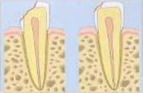Los traumatismos dentales se caracterizan porque no se rigen por un solo mecanismo etiopatogénico, ni siguen un patrón predecible en cuanto a la intensidad o extensión.