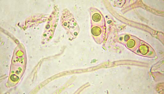 embargo al microscopio rápidamente se ve que es un Dacrymycetal.