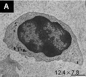 En crustáceos decápodos las reacciones inmune celulares comprenden tres tipos de hemocitos circulantes: células hialinas (HH), células semigranulares (HSG), y células granulares (HG).