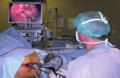 Operaciones endoscópicas transanales (TEO ) Técnicas avanzadas de exéresis y reconstrucción 11 a 6 El rectoscopio quirúrgico TEO está sujeto a un sistema de soporte (KARL STORZ Tuttlingen, Alemania).
