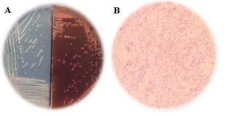 CAPÍTULO IV 4.1 RESULTADOS 4.1.1 Identificación microbiológica Todas las cepas incluidas en el estudio fueron caracterizadas como Acinetobacter spp.