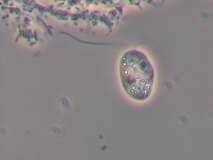 A: Opercularia microdiscum, (400x).