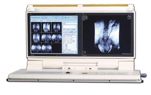 Dornier Estación de trabajo digital Fácil para el usuario por su diseño La pantalla gráfica del usuario permite el control directo con todas las funciones: funcionamiento de rayos X, imagen y gestión