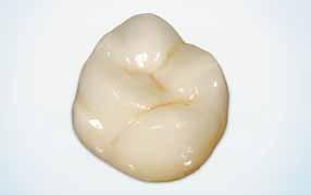 se necesita una masa, Uni light o Uni intense, para la estratificación de los 16 colores de dientes (A1 a D4).