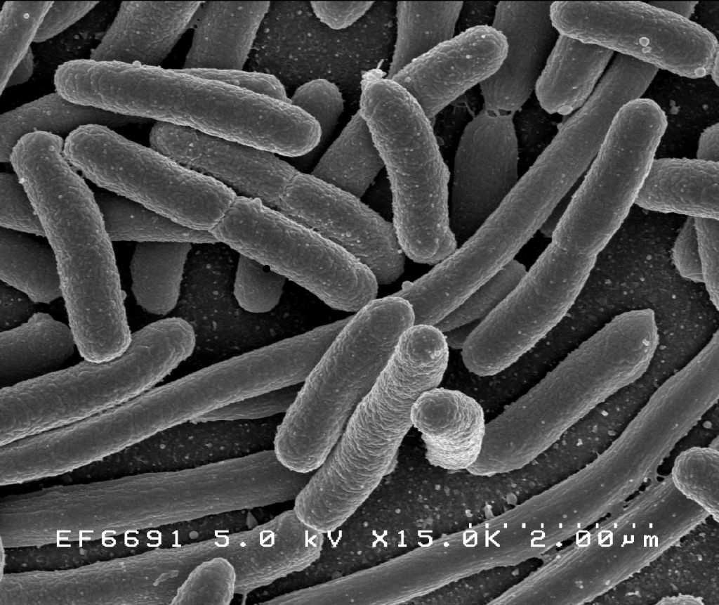 2 Datos de expresión genética. Figura 2.11: Foto de Escherilia Coli, quizás el organismo procariota más estudiado por el ser humano.