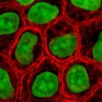 La célula. 2.1 Figura 2.1: Células de la piel humana coloreadas, de verde el núcleo y de rojo la membrana plasmática (Fuente Wikimedia http://commons.wikimedia.org/wiki/file:epithelialcells.jpg).