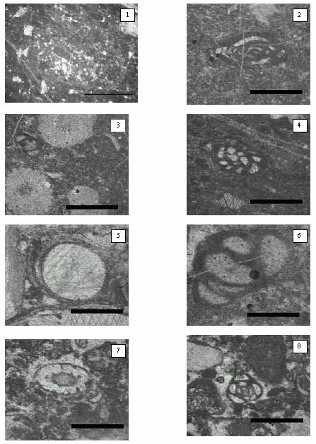 Microfacies 2 Wackestone y grainstone de foraminíferos feros bentónicos, nicos, miliólidos lidos y braquiópodos.