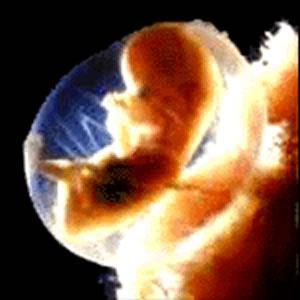 7.- ES EL CÁNCER CONGÉNITO? Durante la gestación puede el feto estar expuesto a radiación con riesgo de producir cáncer como: leucemia congénita.