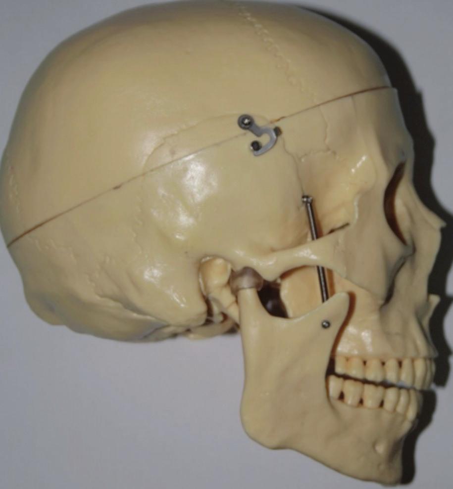 los arcos zigomáticos. en la porción central, hay una numerosa presencia de orificios, apófisis y articulaciones. El orificio magno es el reparo más evidente de la base del cráneo.