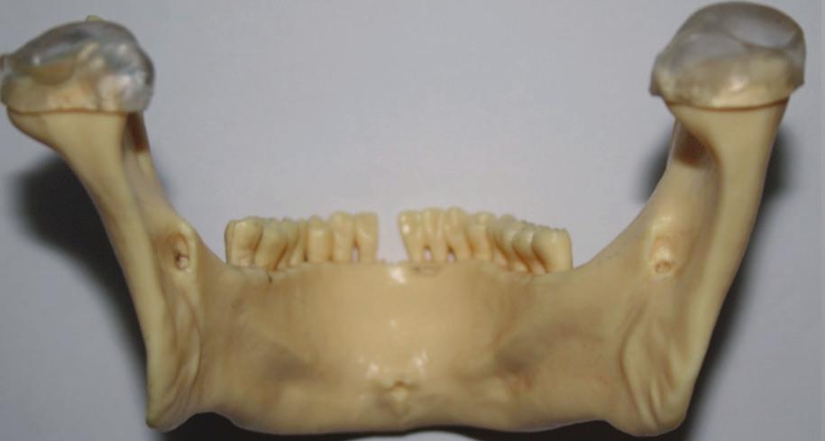 los que se articulan las raíces de los dientes superiores. Nasales: son un par de huesos con forma cuadrilátera.