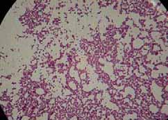 exopolisacáridos bacterianos. Cepa pura de Staphylococcus aureus teñida con Gram.