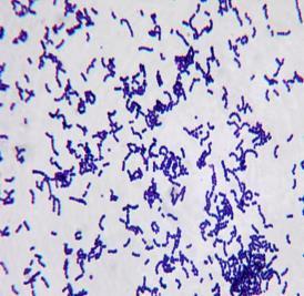 Streptococcus sp.